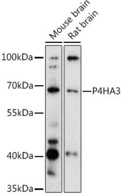 Western Blot: P4HA3 AntibodyAzide and BSA Free [NBP2-94641]